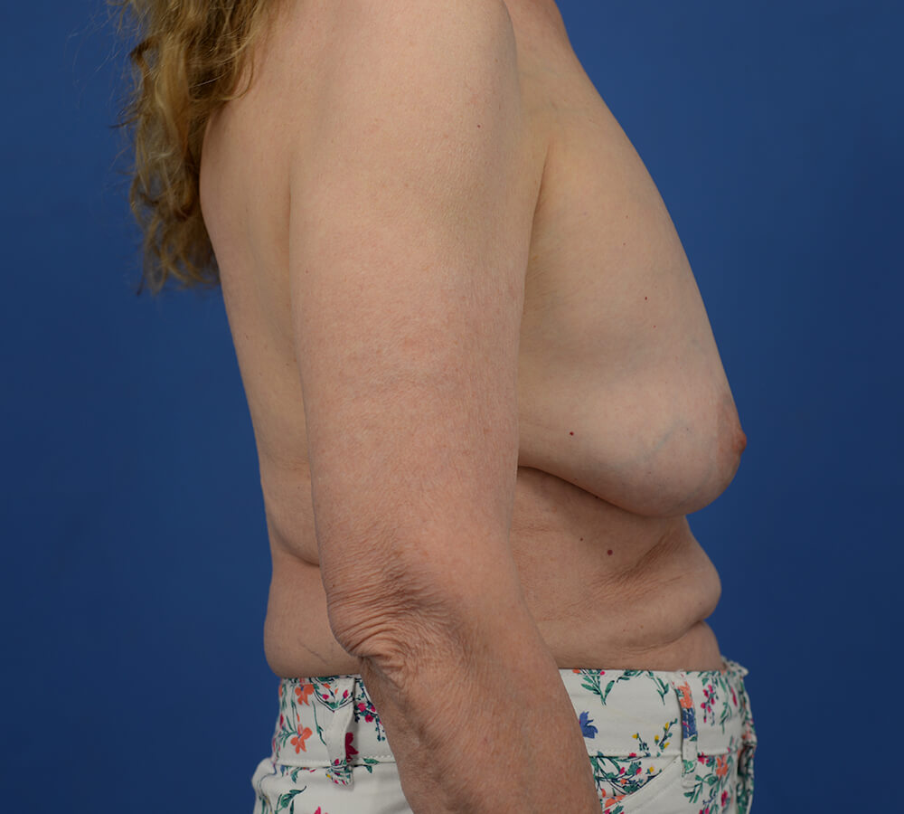 Case--2079 | Before  5