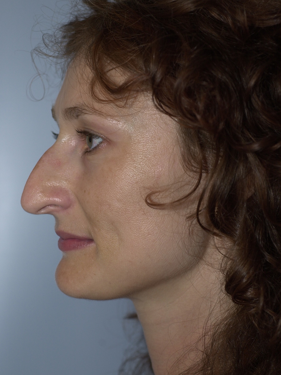 Case--4302 | Before Face 5